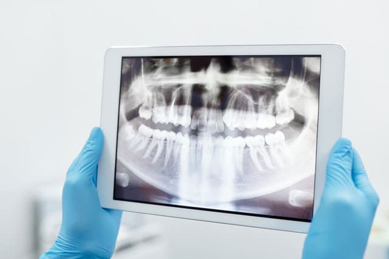 تصاویر دیجیتالی یک تکنولوژی دندانپزشکی